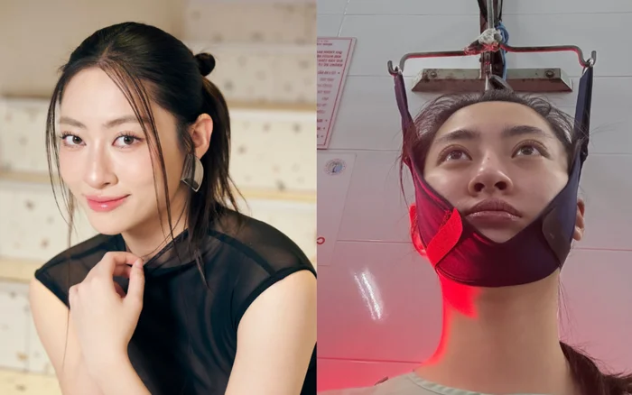 Tình trạng của Lương Thuỳ Linh sau nửa năm vào viện điều trị sức khoẻ